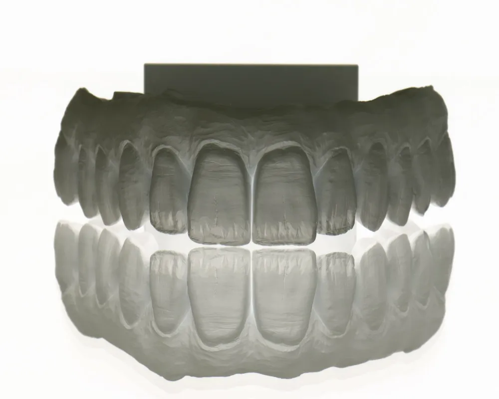 All-Ceramic Zirconia for the highest demands