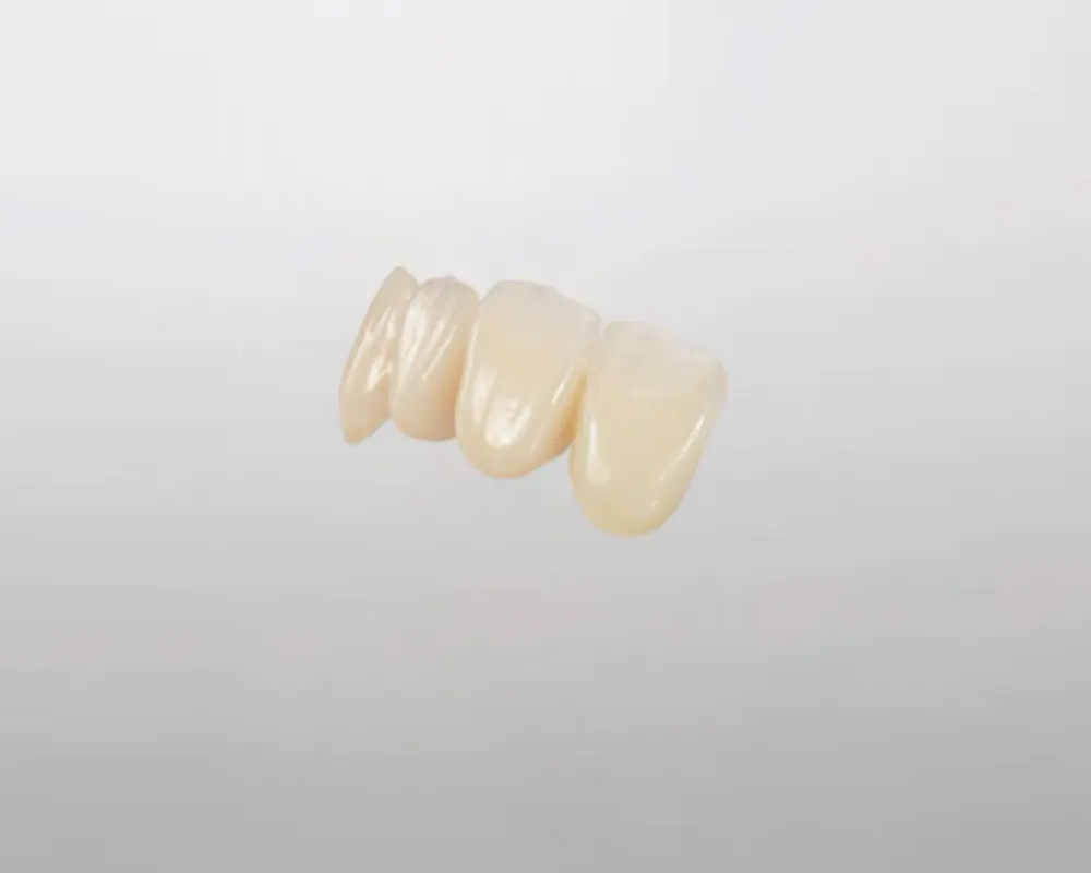 All-Ceramic Zirconia for the highest demands