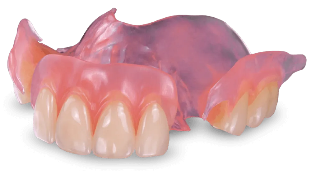 Flexible Partial Denture Finished With Model