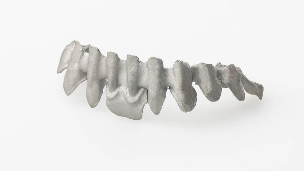 SLM - Single coping or Coping bridge unfinished